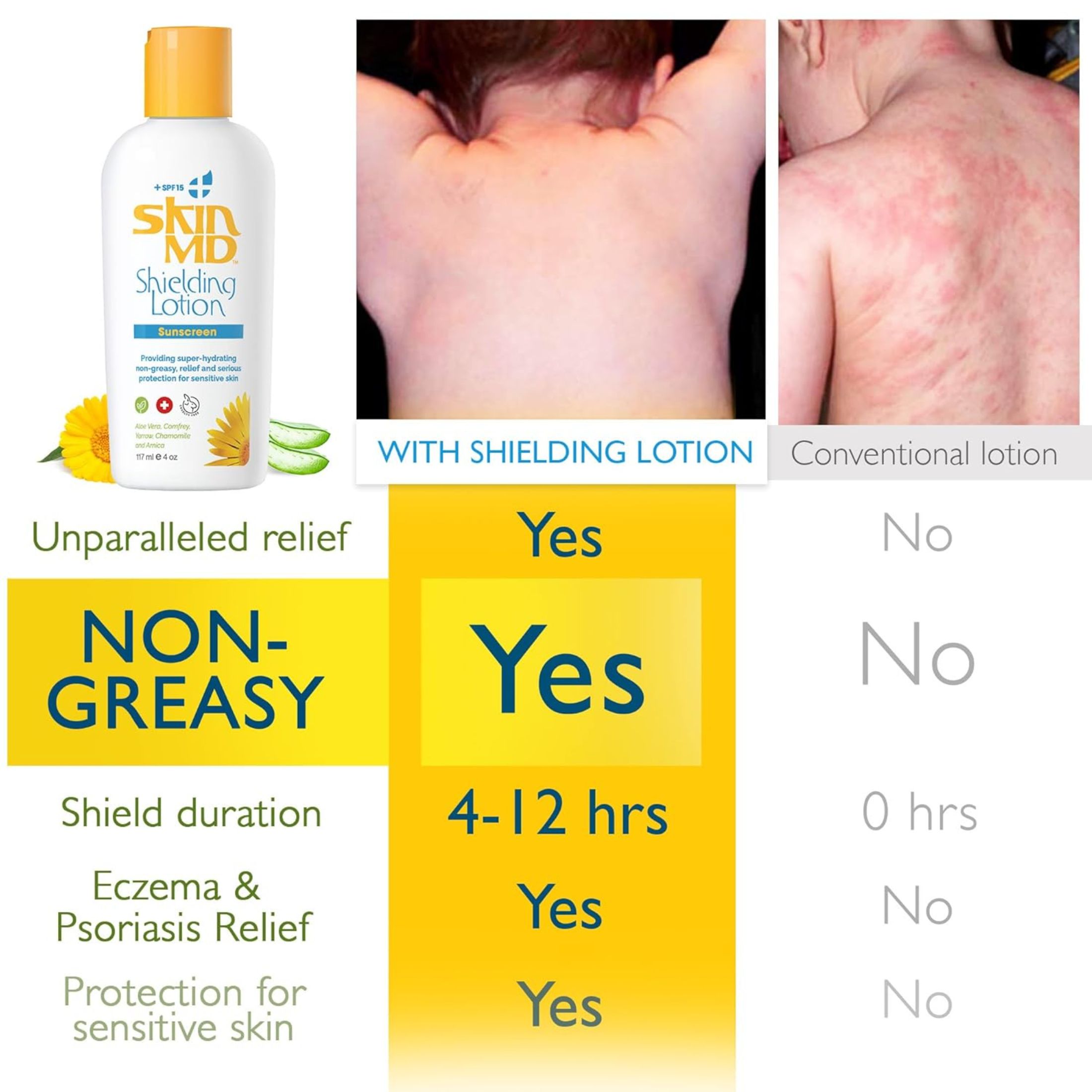 Skin Md Natural Shielding Sunscreen Lotion SPF 15