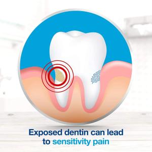 Sensodyne Extra Whitening Sensitivity Protection Toothpaste - 6 Oz