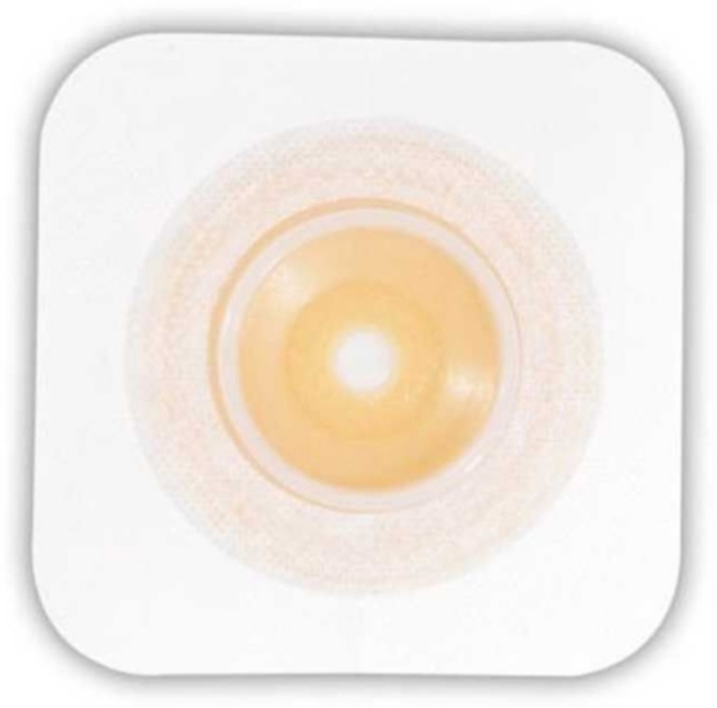 Convatec 411803 Sur-fit Natura Moldable Stomahesive Skin Barrier – 10 Per Box