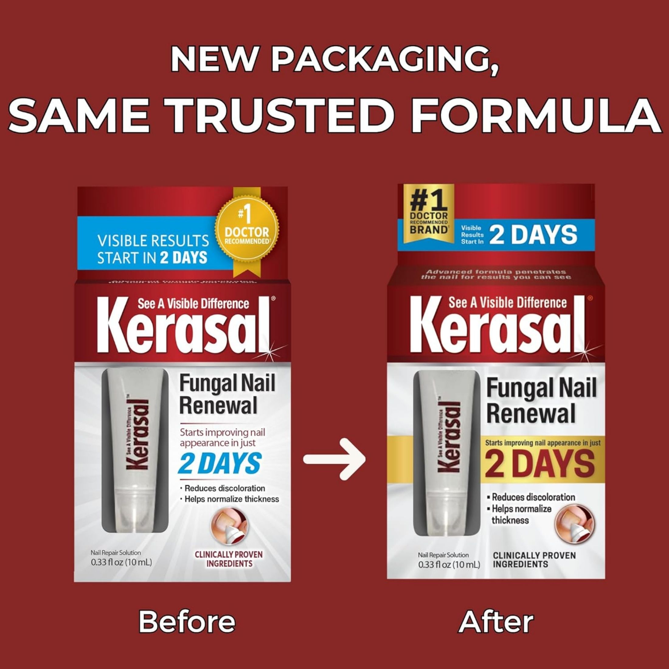 Kerasal Fungal Nail Renewal Treatment - 0.33 Fl Oz