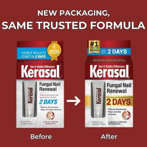 Kerasal Fungal Nail Renewal Treatment - 0.33 Fl Oz