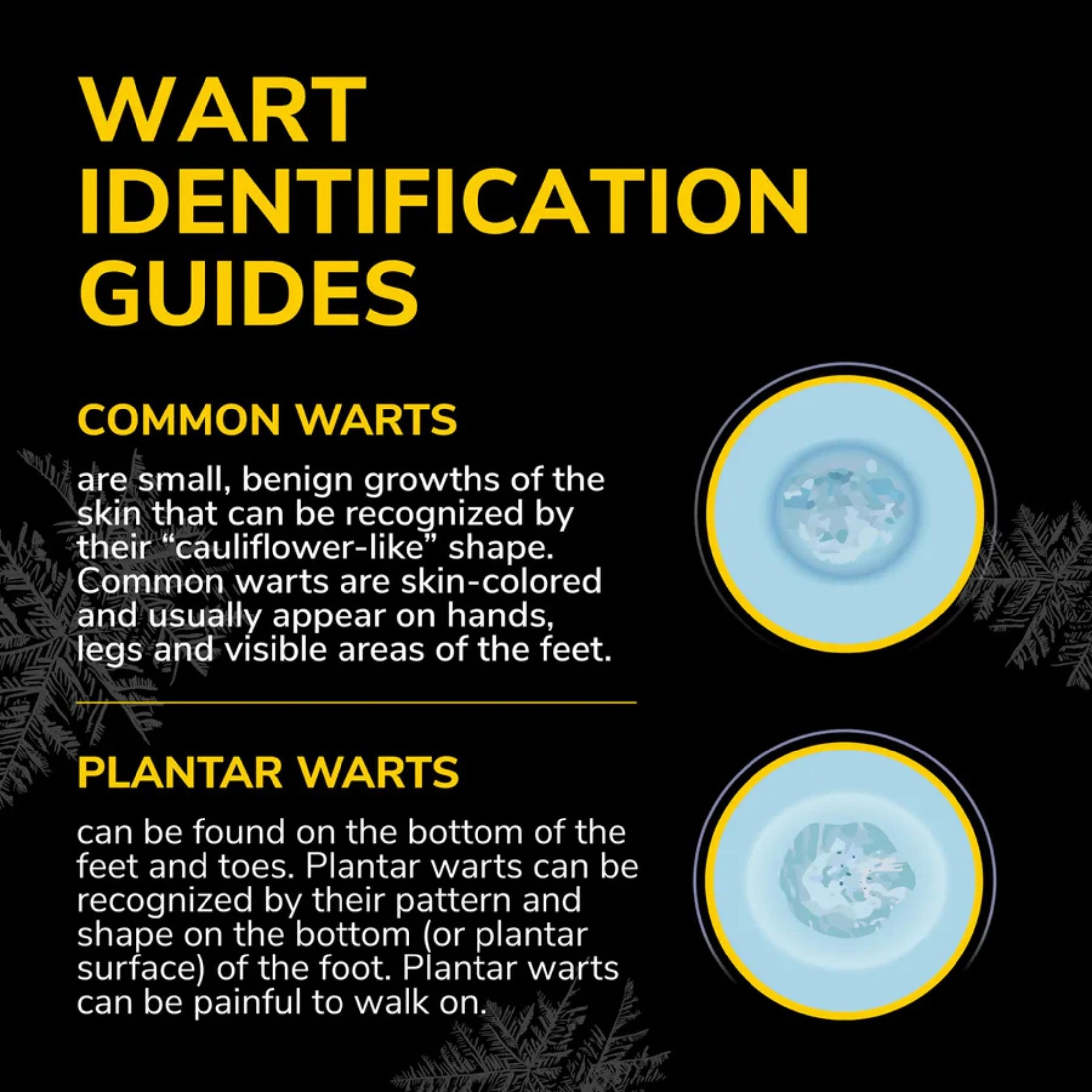 Dr. Scholl's Freeze Away Max Wart Remover - 10 Applications