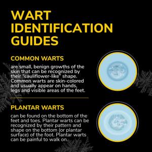 Dr. Scholl's Freeze Away Max Wart Remover - 10 Applications