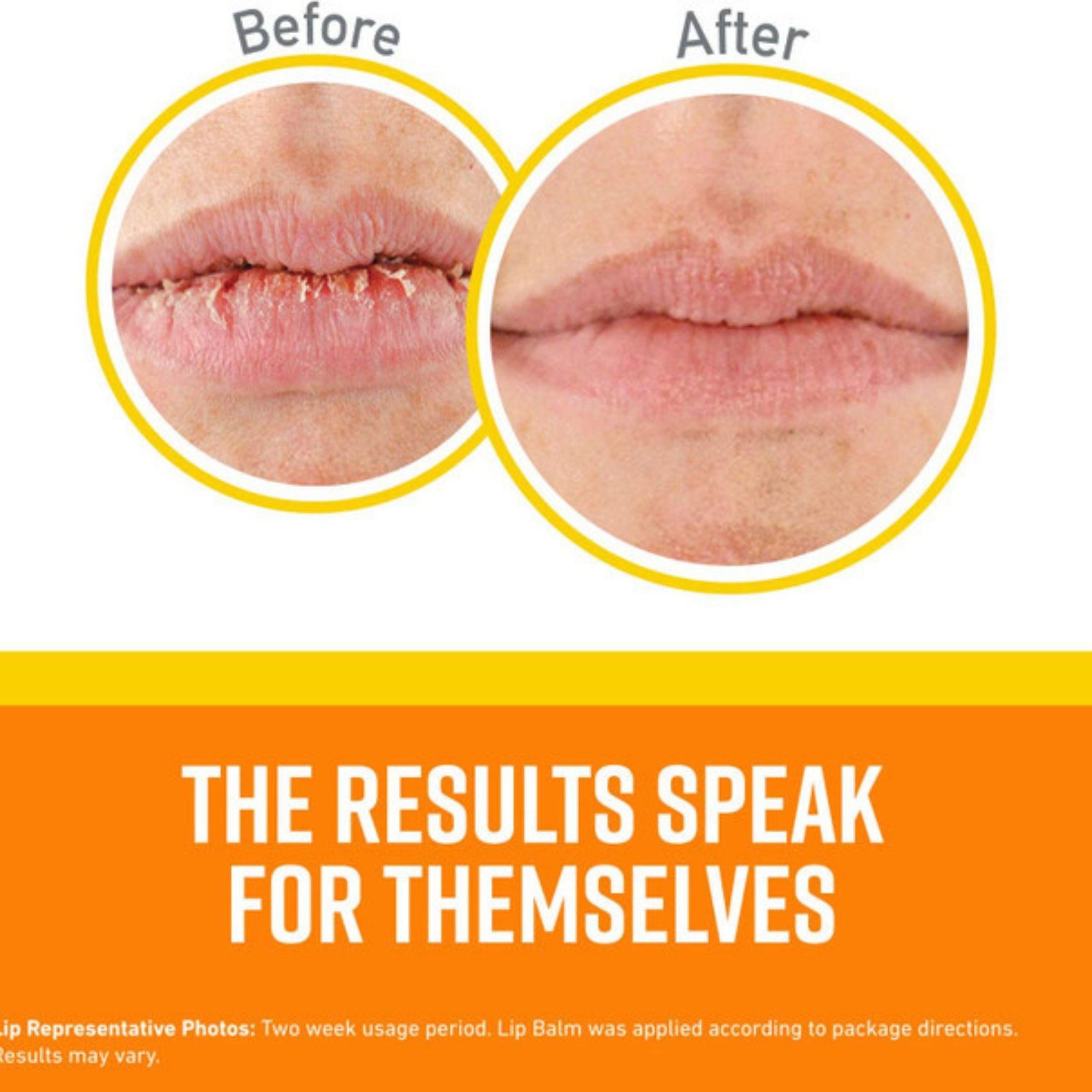 O'Keeffe's K0900002 SPF 35 Lip Repair Balm, 0.15 Oz, Stick