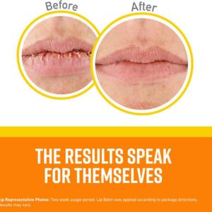 O'Keeffe's K0900002 SPF 35 Lip Repair Balm, 0.15 Oz, Stick