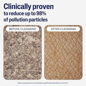 Cetaphil Gentle Clear Pore Clearing Acne Cleanser