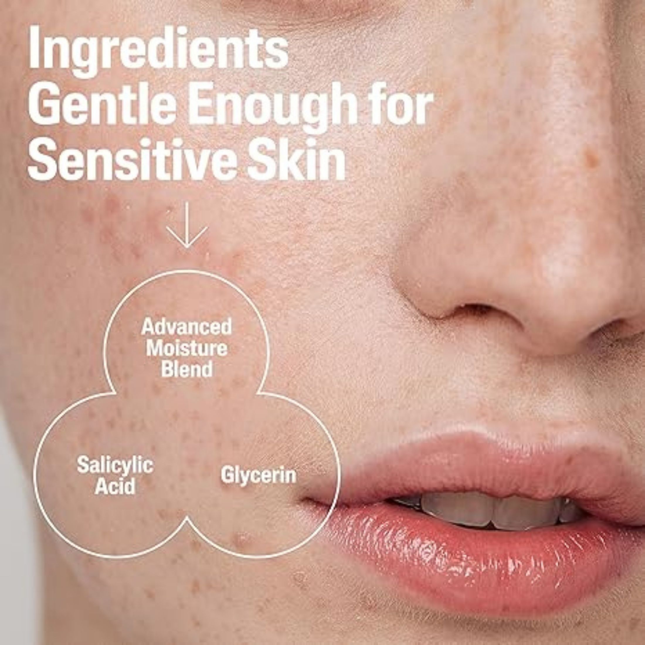 Cetaphil Gentle Clear Pore Clearing Acne Cleanser