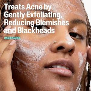 Cetaphil Gentle Clear Pore Clearing Acne Cleanser