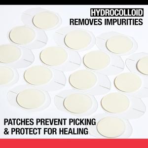 Neutrogena Stubborn Acne Hydrocolloid Blemish Patches