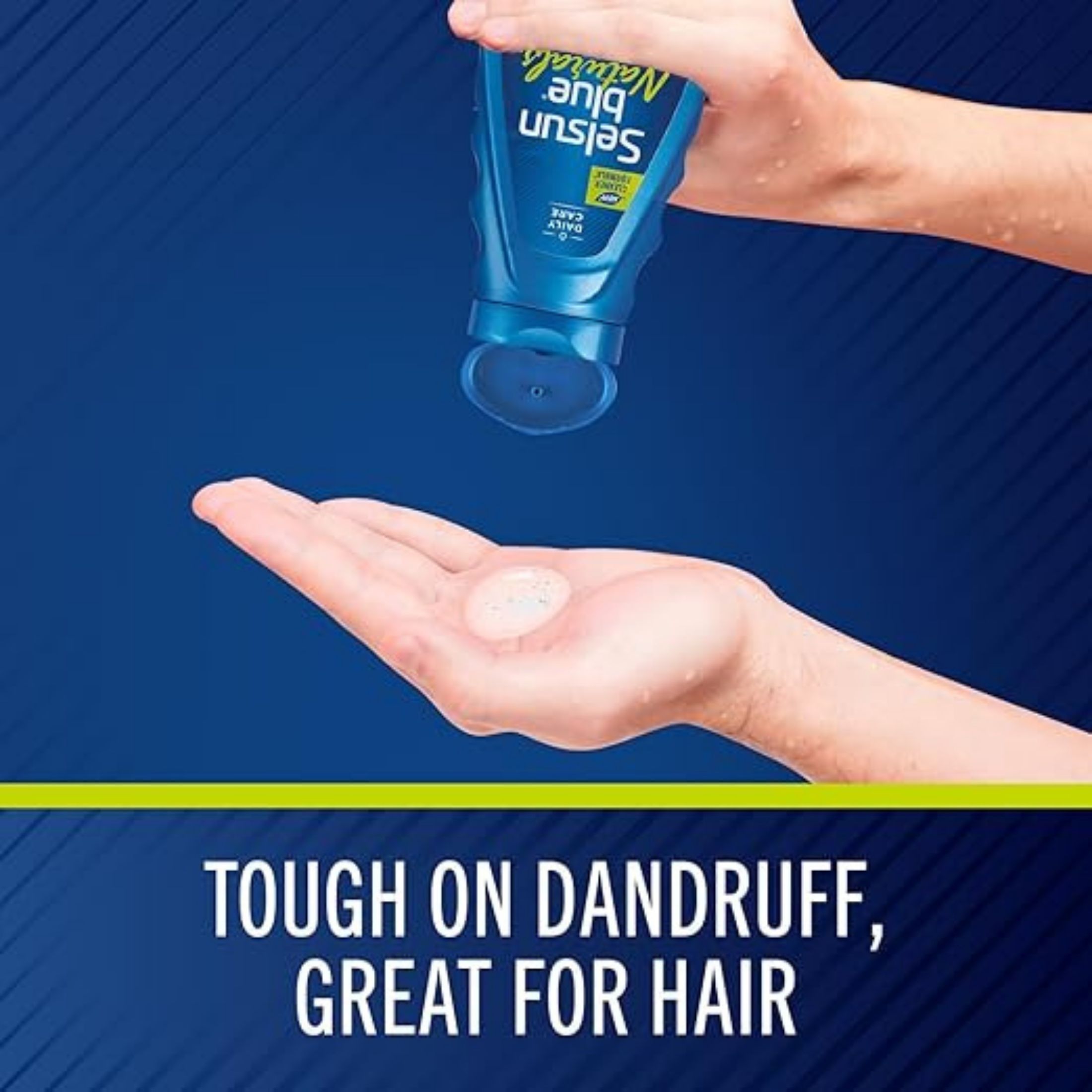 Selsun Blue Itchy Dry Scalp Shampoo - 11 Fl Oz