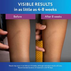 ScarAway Gel, 100% Silicone,0.35oz