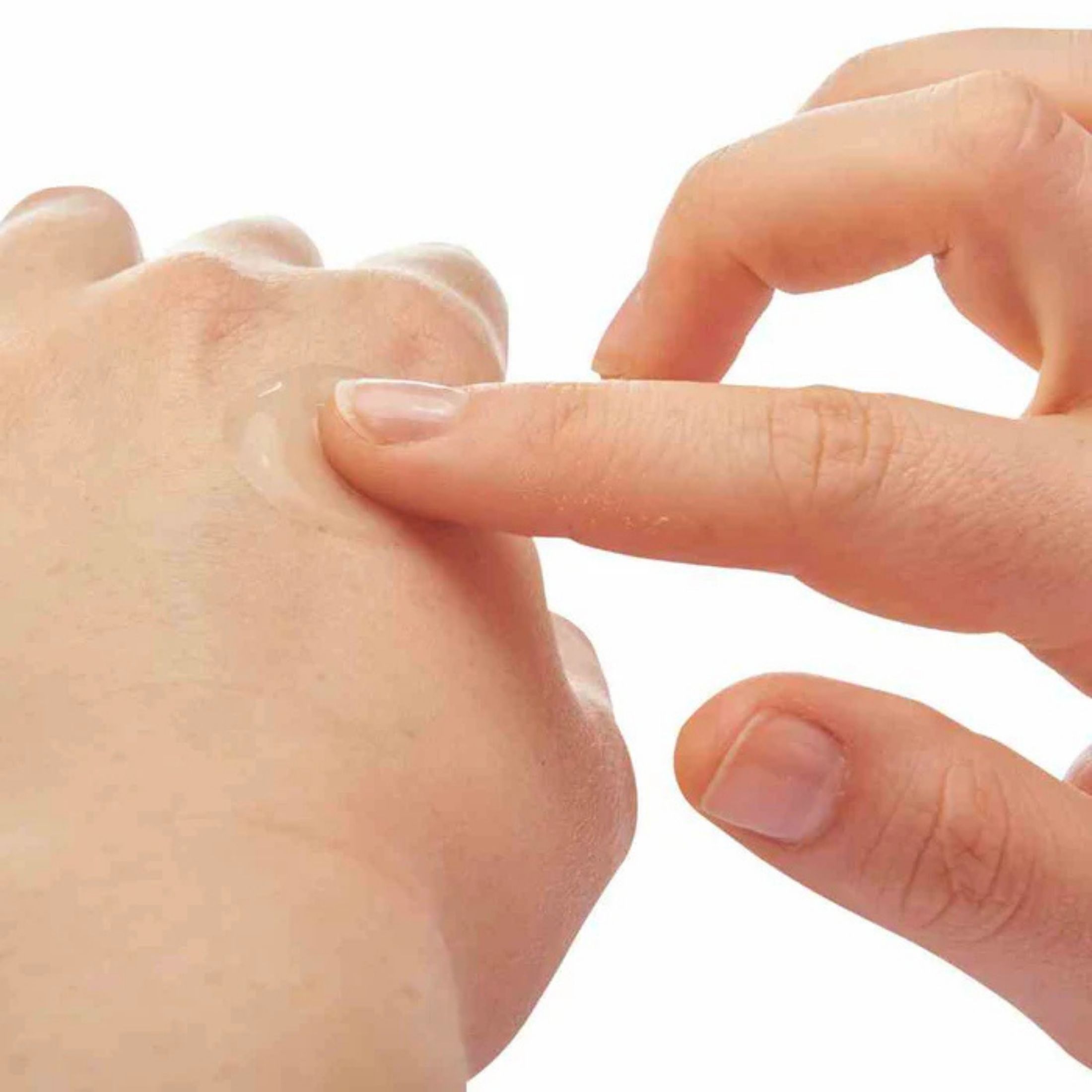 After Bite Xtra Soothing Sting Treatment Gel 0.7 Oz