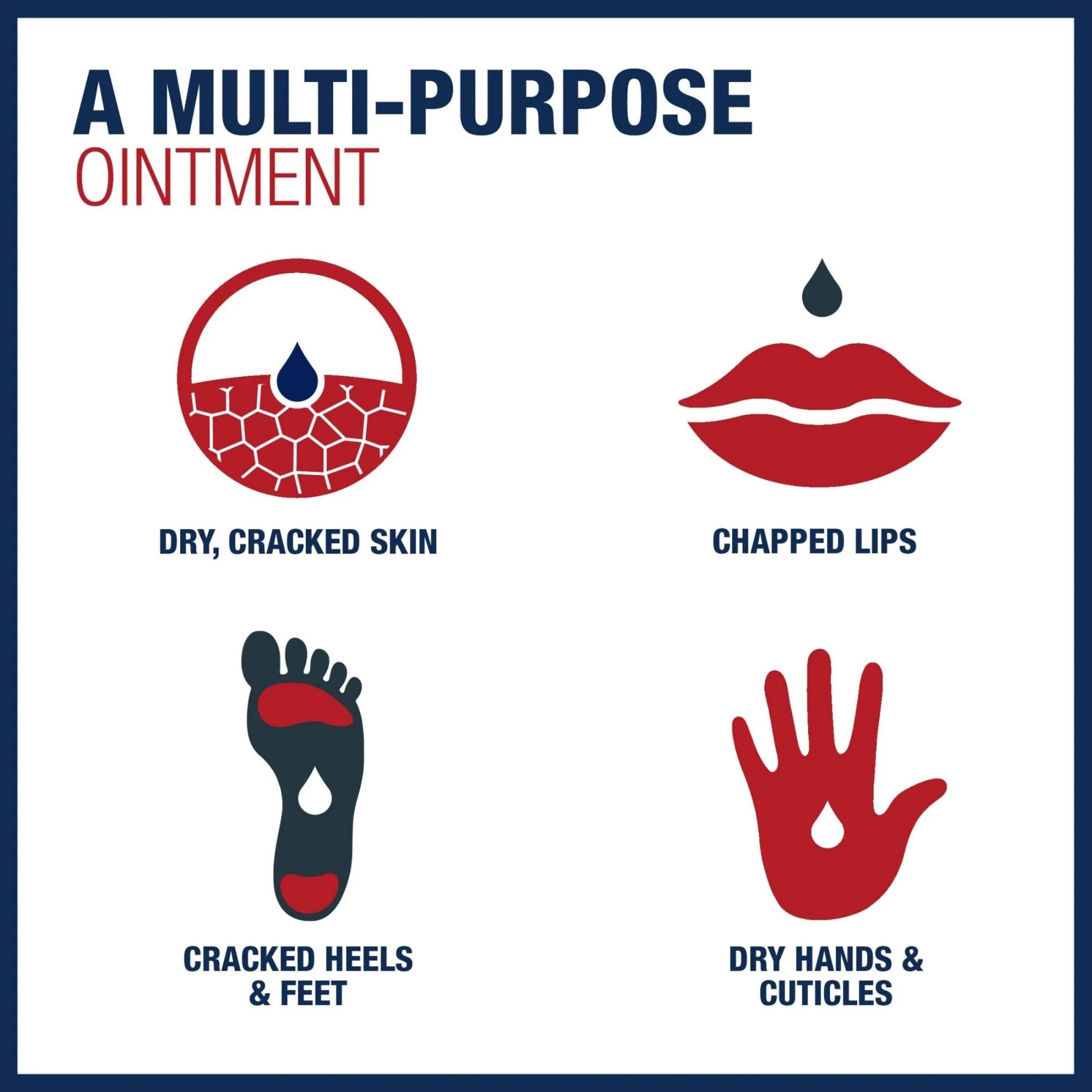 Aquaphor Advanced Therapy Healing Ointment Skin Protectant Tube