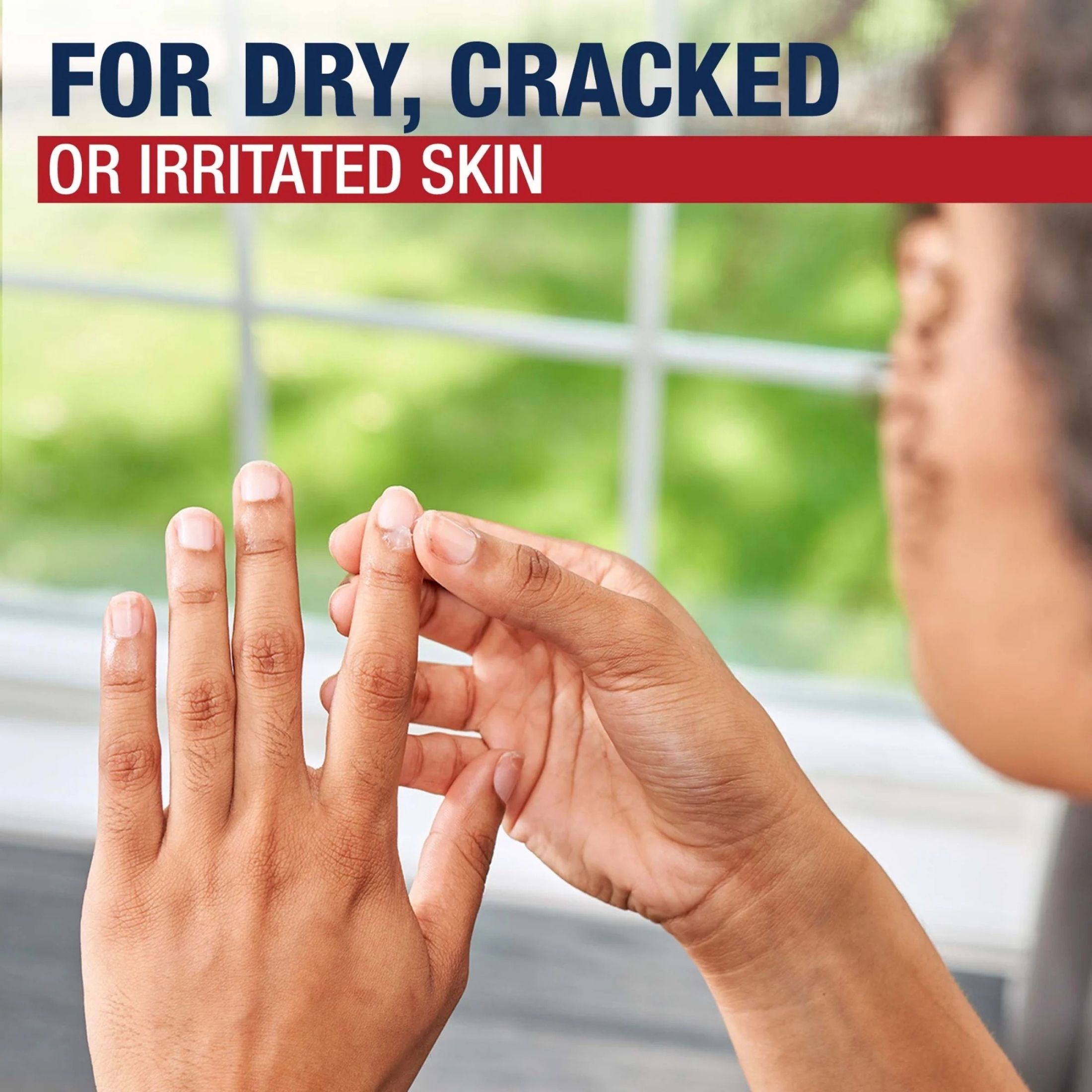 Aquaphor Advanced Therapy Healing Ointment Skin Protectant Tube