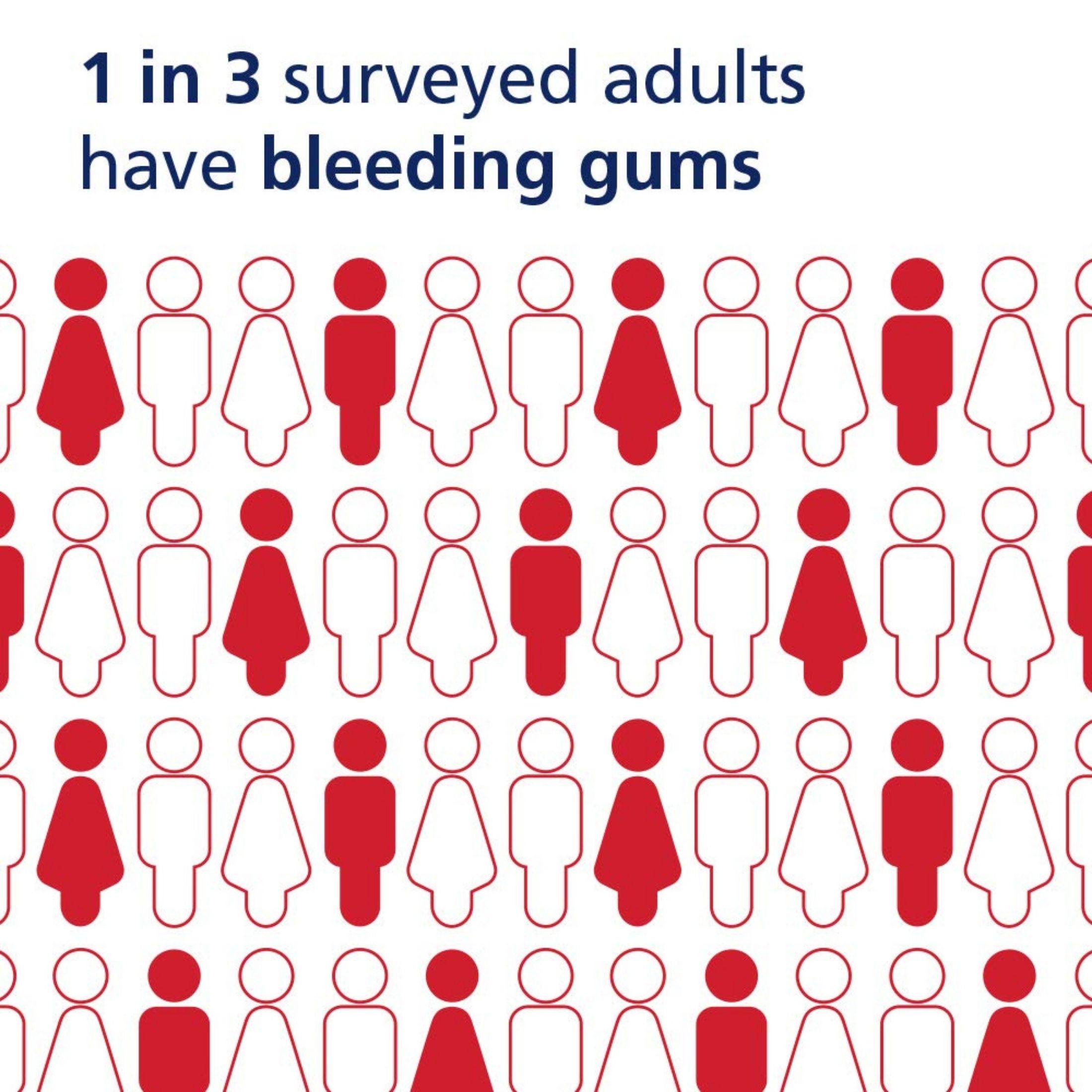 Parodontax Gingivitis Toothpaste For Bleeding Gums Clean Mint