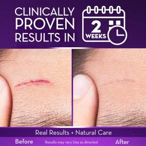 Cicatricure Face & Body Scar Gel 1 Oz