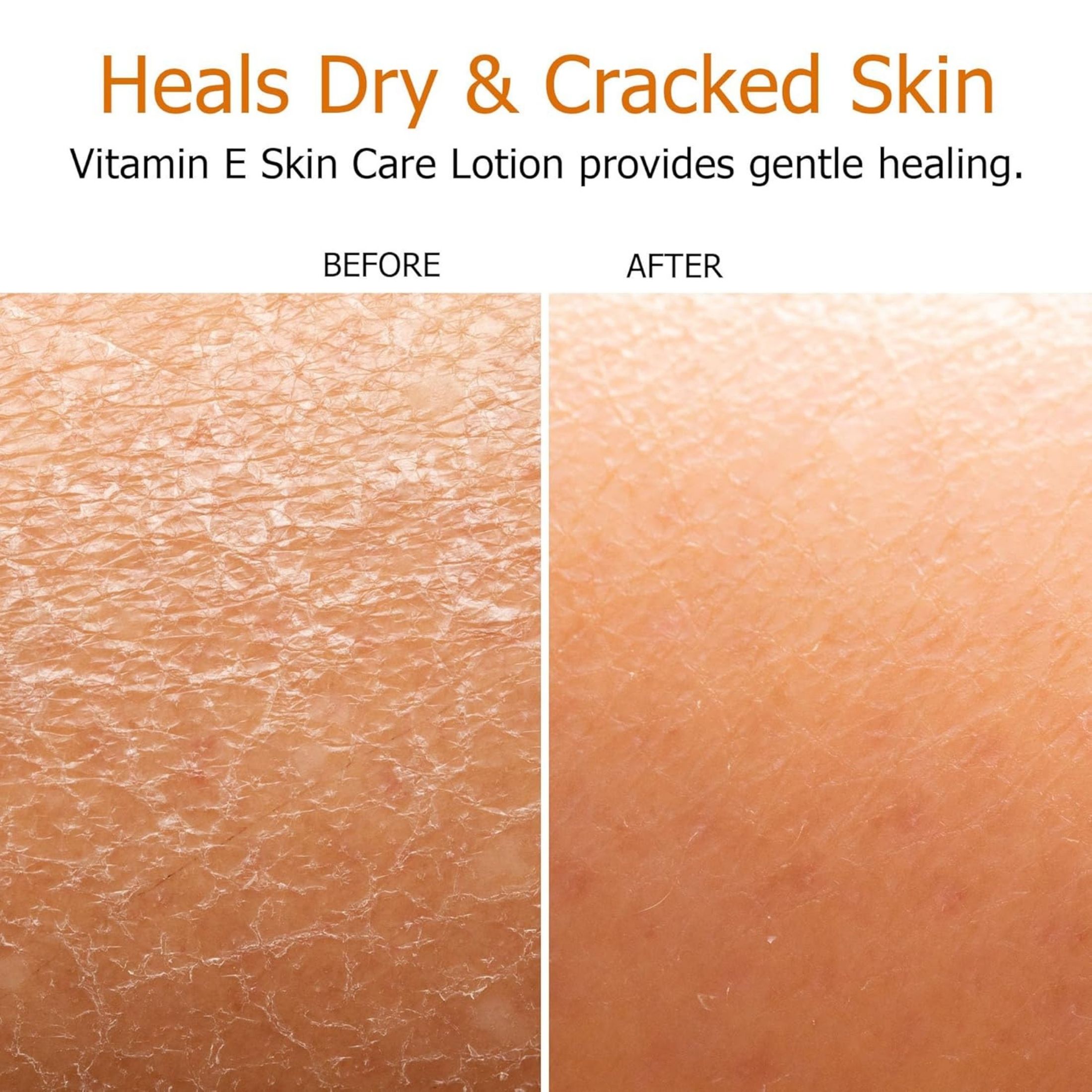 Fruit of the Earth Skin Care Lotion, Vitamin E 4 Oz