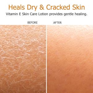 Fruit of the Earth Skin Care Lotion, Vitamin E 4 Oz