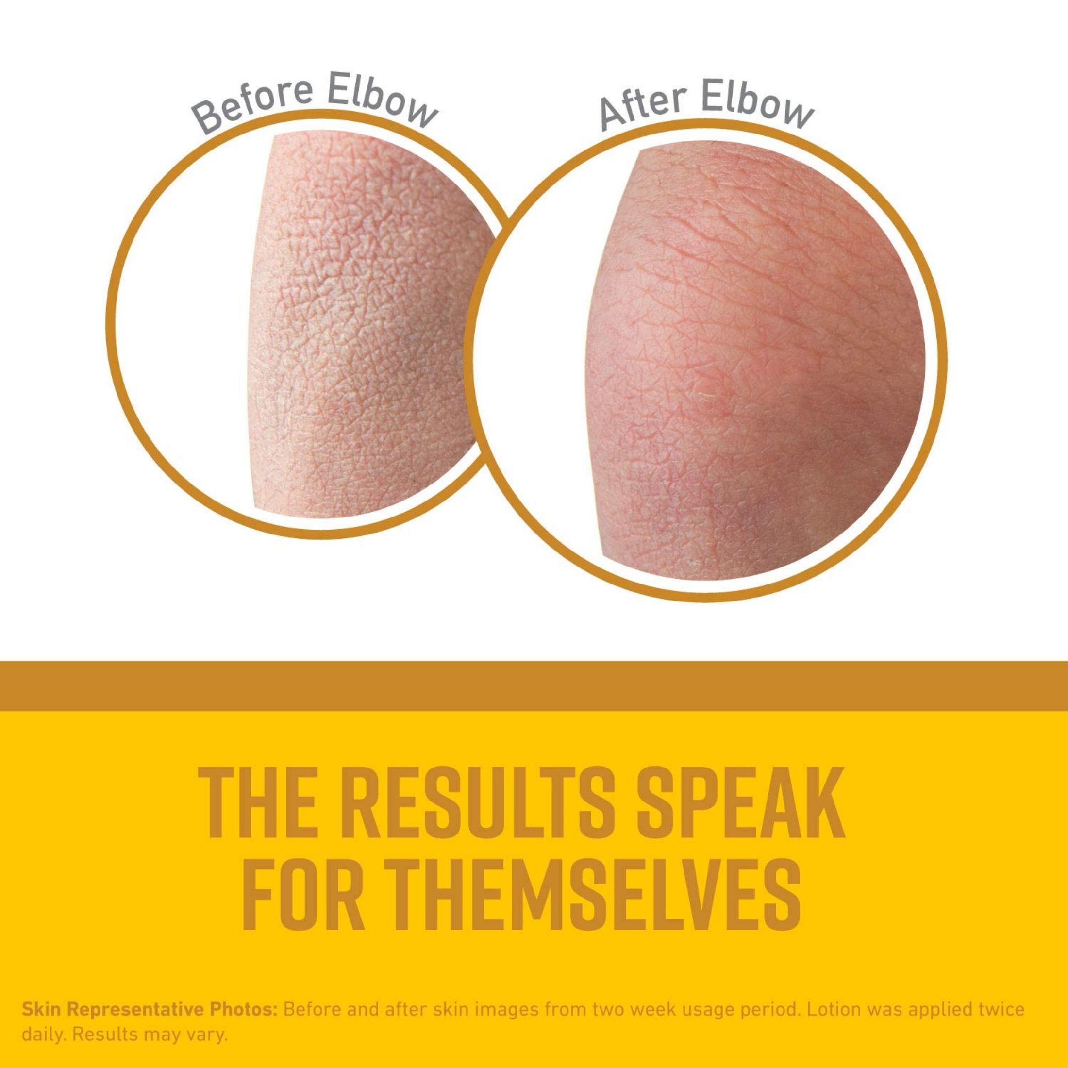 O'Keeffe's Skin Repair Body Lotion Tube 7 Oz