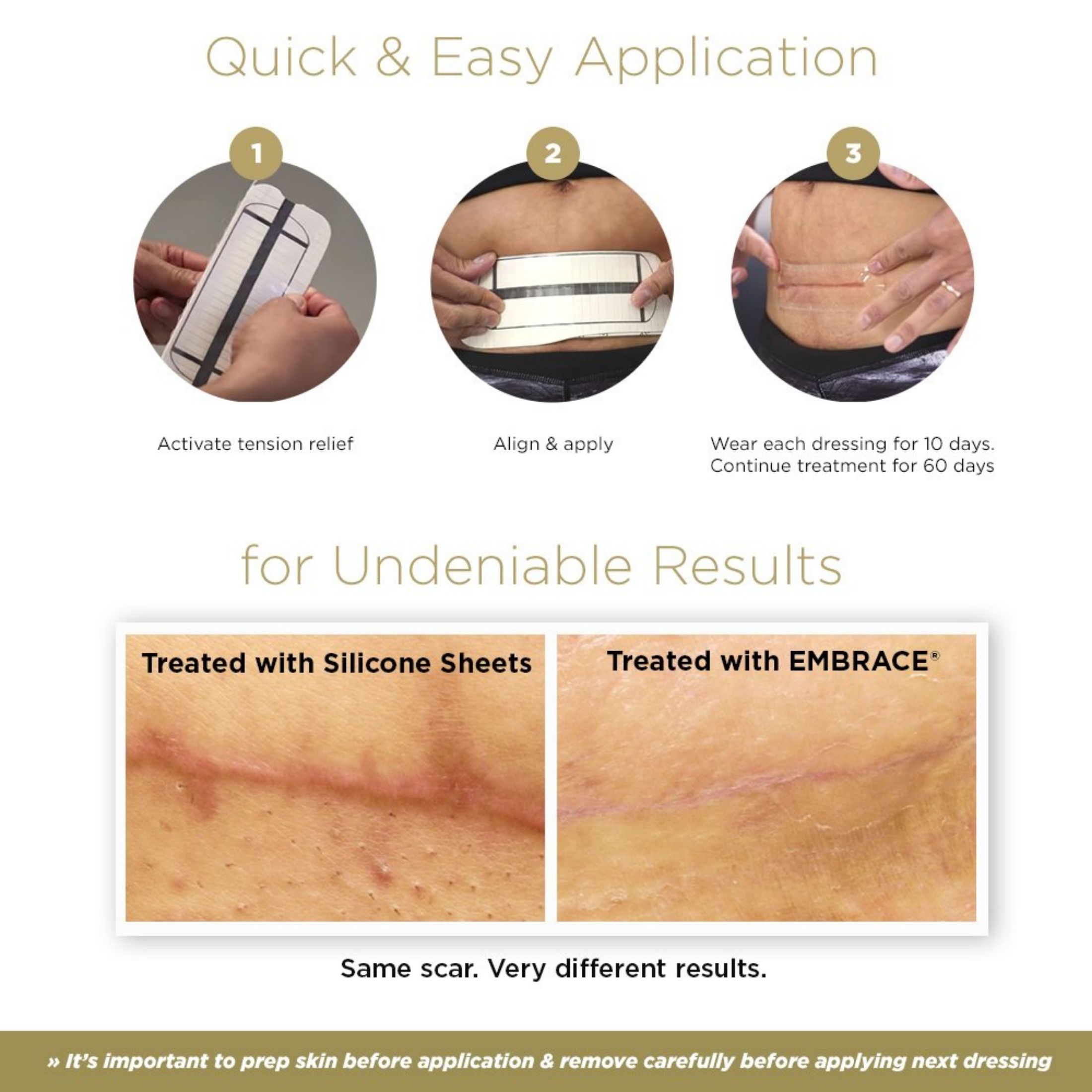 Embrace Active Scar Defense Silicone Sheets For New Scars 30 Folhas