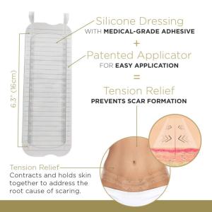 Embrace Active Scar Defense Silicone Sheets For New Scars 30 Folhas