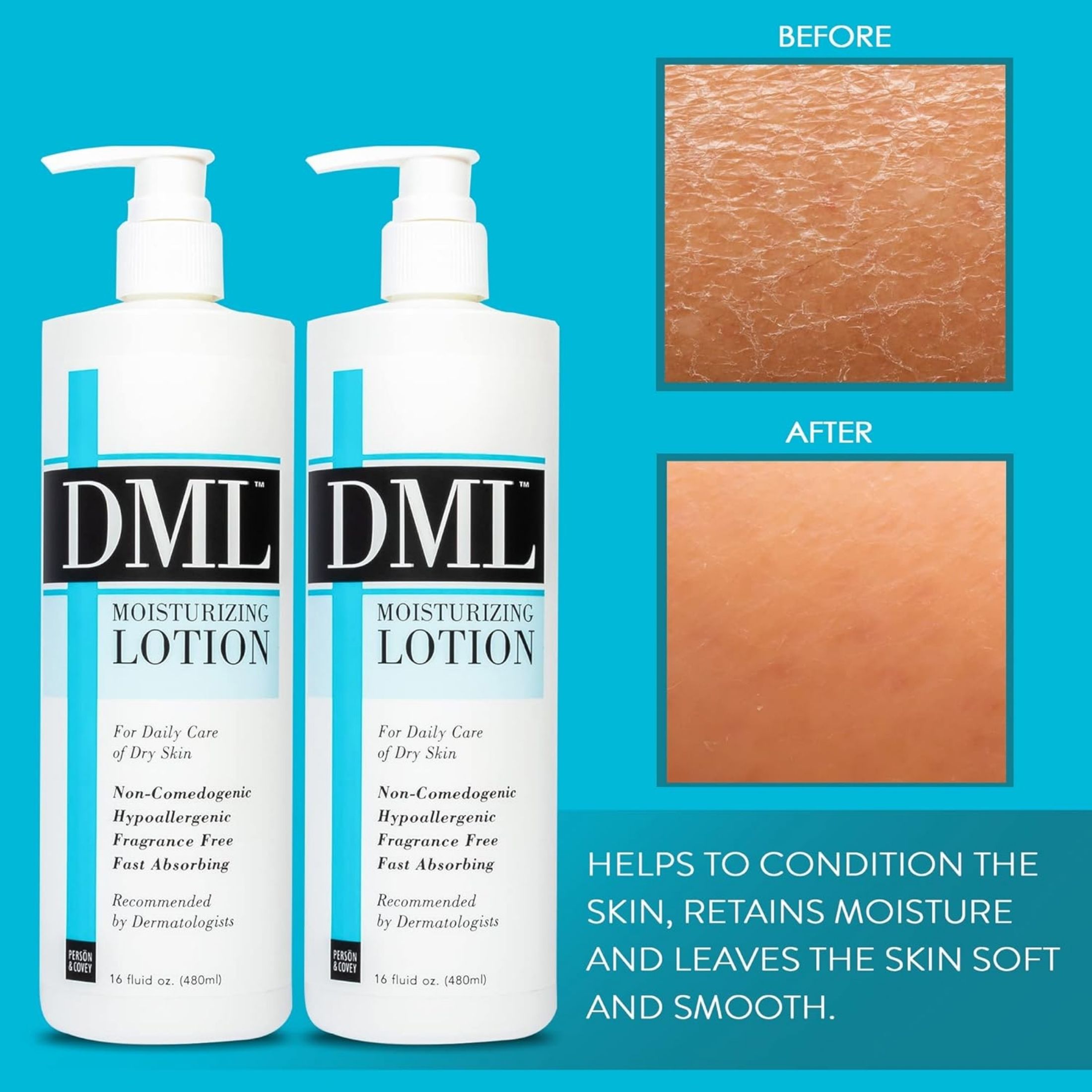 DML Moisturizing Lotion 16 Oz