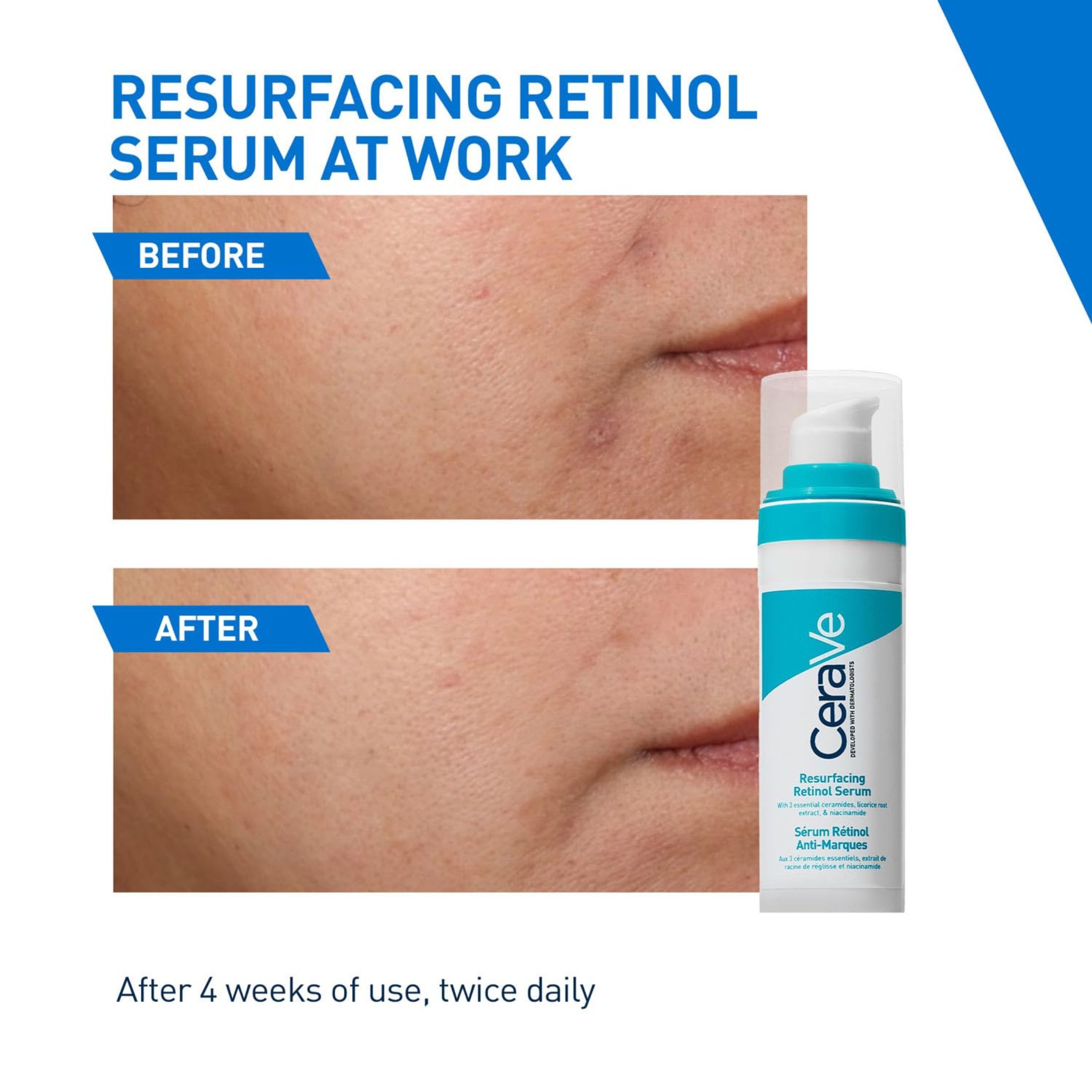 Cerave Acne Resurfacing Serum