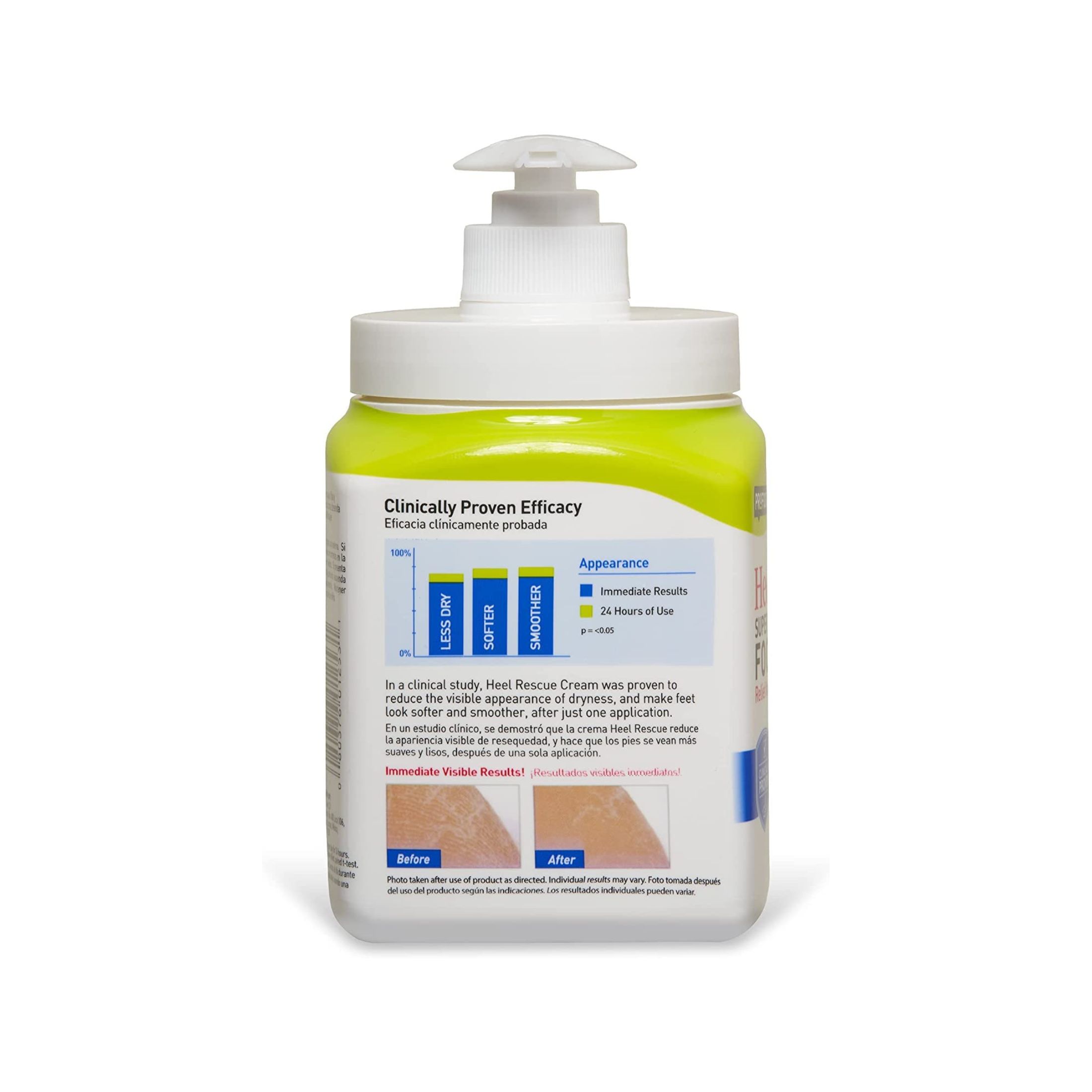 Profoot Care Heel Rescue Superior Moisturizing Cream, 16 Oz
